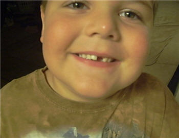 jadens loose teeth, 2
